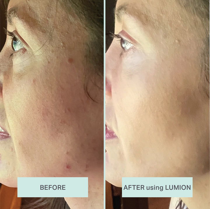 Save My Skin Serum