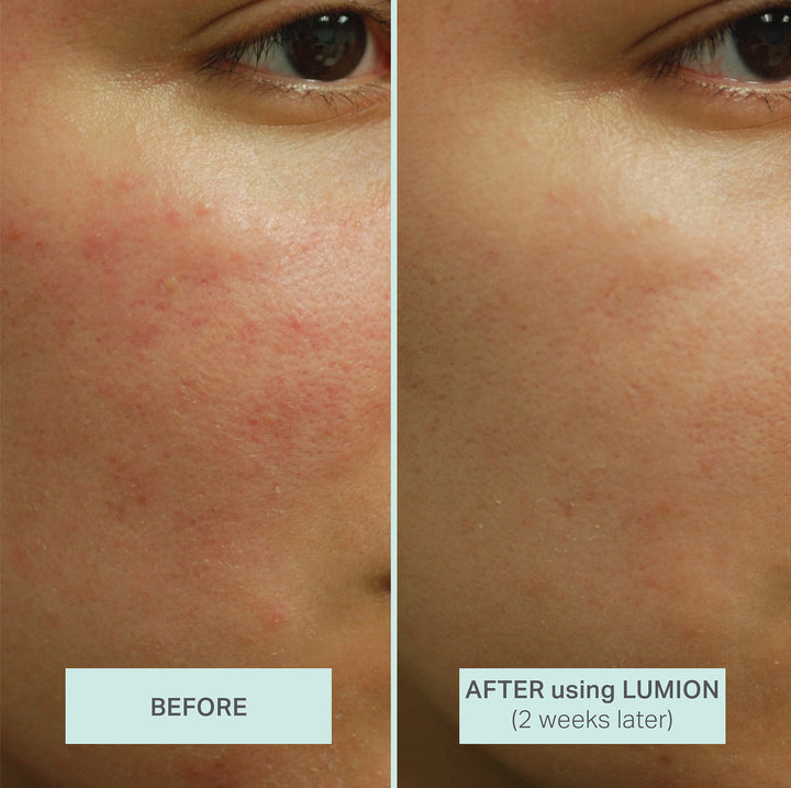 Before and After using Lumion (2 weeks later)