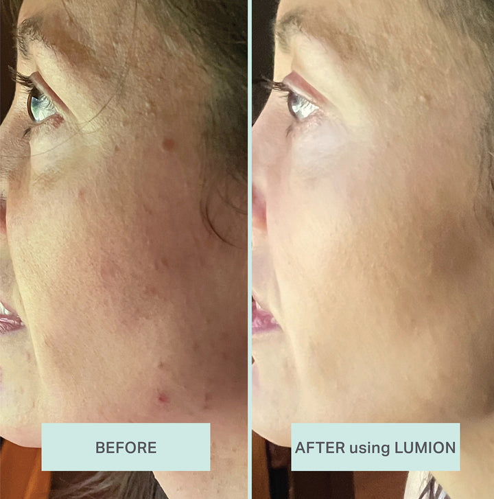 Before and After using Lumion